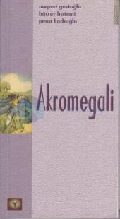 Akromegali