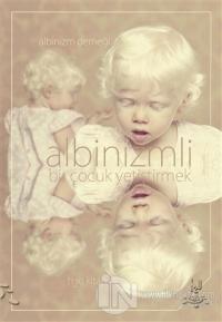 Albinizmli Bir Çocuk Yetiştirmek