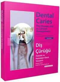 Diş Çürüğü - Dental Caries