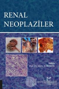 Renal Neoplaziler