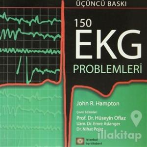 150 EKG Problemleri
