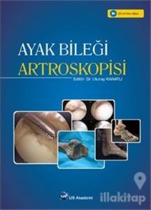 Ayak Bileği Artroskopisi