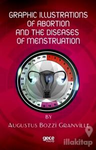 Graphic Illustrations Of Abortion And The Diseases Of Menstruation
