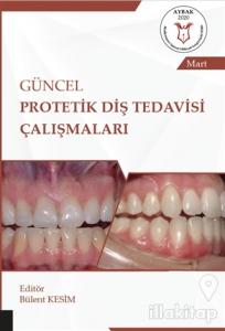 Güncel Protetik Diş Tedavisi Çalışmaları - Mart