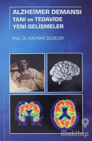 Alzheimer Demansı Tanı ve Tedavide Yeni Gelişmeler