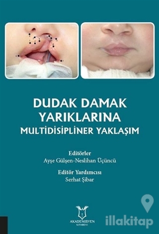 Dudak Damak Yarıklarına Multidisipliner Yaklaşım