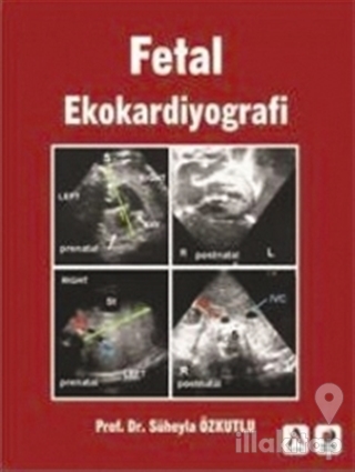 Fetal Ekokardiyografi (Ciltli)