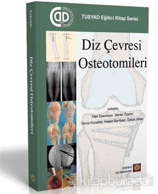 Diz Çevresi Osteotomileri İrfan Esenkaya