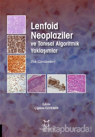 Lenfoid Neoplaziler ve Tanısal Algoritmik Yaklaşımlar