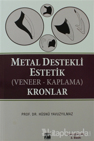 Metal Destekli Estetik (Veneer-Kaplama)Kronlar (Ciltli)