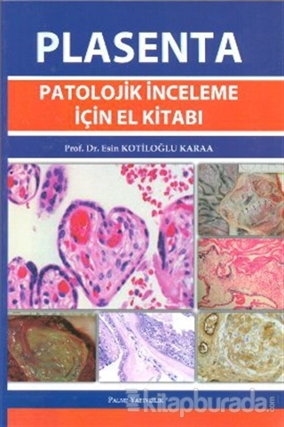 Plasenta Patolojik İnceleme için El Kitabı %15 indirimli Esin Kotiloğl