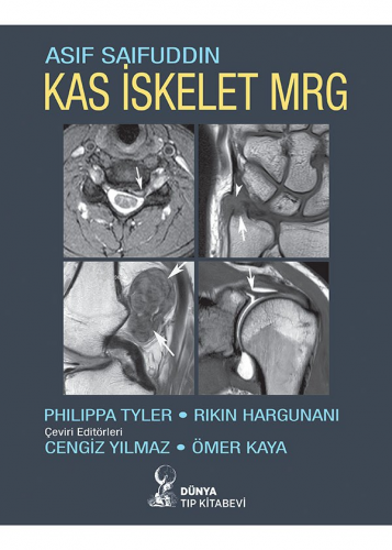 Kas İskelet Mrg - Kitapiks.com