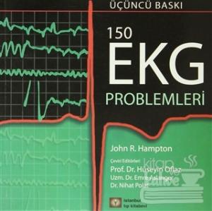 150 EKG Problemleri