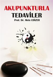 Akupunkturla Tedaviler