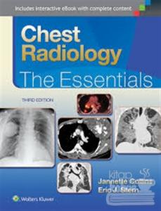 Chest Radiology