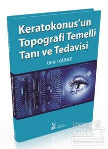 Keratokonus'un Topografi Temelli Tanı ve Tedavisi (Ciltli)