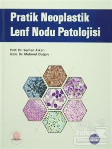 Pratik Neoplastik Lenf Nodu Patolojisi (Ciltli)