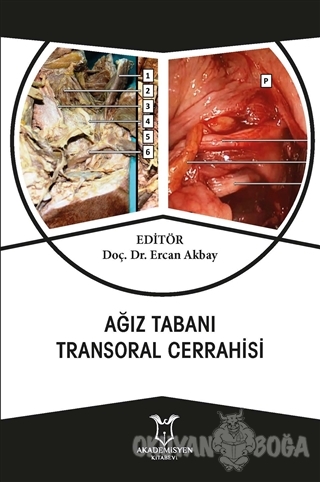 Ağız Tabanı Transoral Cerrahisi - Ercan Akbay - Akademisyen Kitabevi