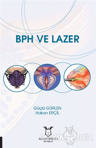 BPH ve Lazer - Güçlü Gürlen - Akademisyen Kitabevi
