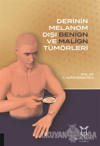 Derinin Melanom Dışı Benign ve Malign Tümörleri - C. Alper Kemaloğlu -