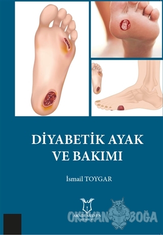 Diyabetik Ayak ve Bakımı - İsmail Toygar - Akademisyen Kitabevi