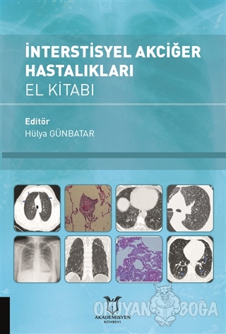İnterstisyel Akciğer Hastalıkları El Kitabı - Hülya Günbatar - Akademi