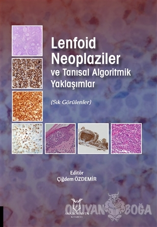 Lenfoid Neoplaziler ve Tanısal Algoritmik Yaklaşımlar - Kolektif - Aka