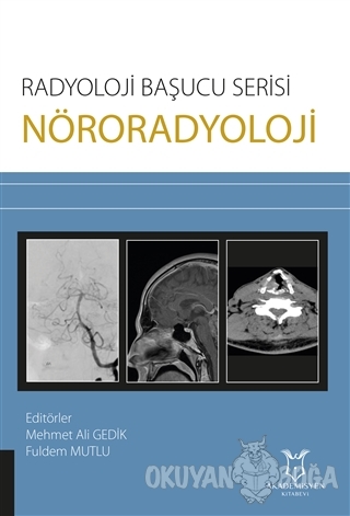 Nöroradyoloji - Radyoloji Başucu Serisi - Mehmet Ali Gedik - Akademisy