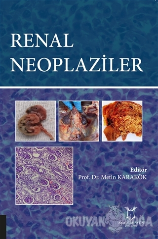 Renal Neoplaziler - Kolektif - Akademisyen Kitabevi