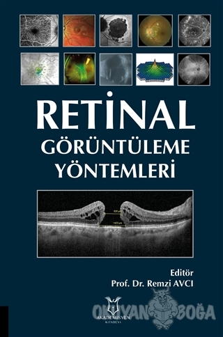 Retinal Görüntüleme Yöntemleri - Remzi Avcı - Akademisyen Kitabevi