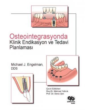 Osteointegrasyonda Klinik Endikasyon ve Planlama Michael J. Engelman