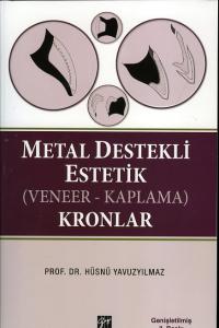 Metal Destekli Estetik Kronlar