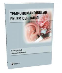 Güneş Tıp Temporomandibular Eklem Cerrahisi