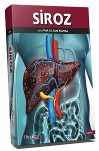 Siroz