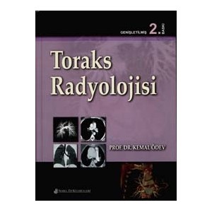 Toraks Radyolojisi - Kemal Ödev