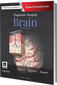 Elsevier Diagnostic Imaging Brain