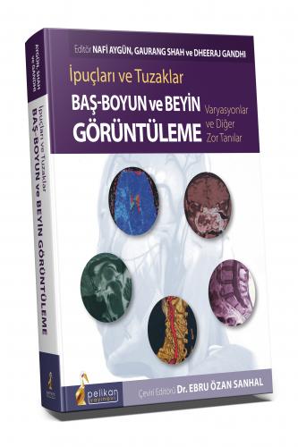 Baş - Boyun ve Beyin Görüntüleme İpuçları ve Tuzaklar Varyasyonlar ve Diğer Zor Tanılar