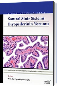Nobel Tıp Biyopsilerin Yorumu, Santral Sinir Sistemi Biyopsi Yorumları