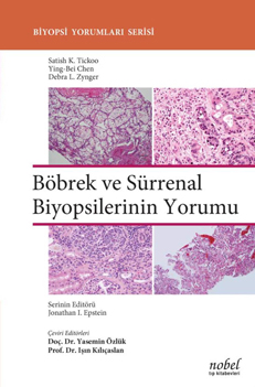 Nobel Tıp Böbrek ve Sürrenal Biyopsilerinin Yorumu - Biyopsi Yorumları Serisi