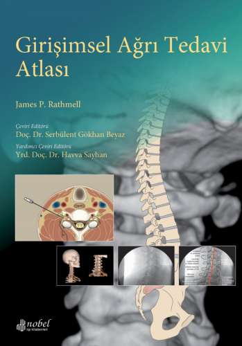 Nobel Tıp Girişimsel Ağrı Tedavi Atlası