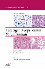 Nobel Tıp Karaciğer Biyopsilerinin Yorumlanması Biyopsi Yorumları Seri