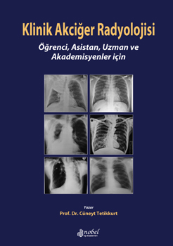 Nobel Tıp Klinik Akciğer Radyolojisi: Öğrenci, Asistan, Uzman ve Akade